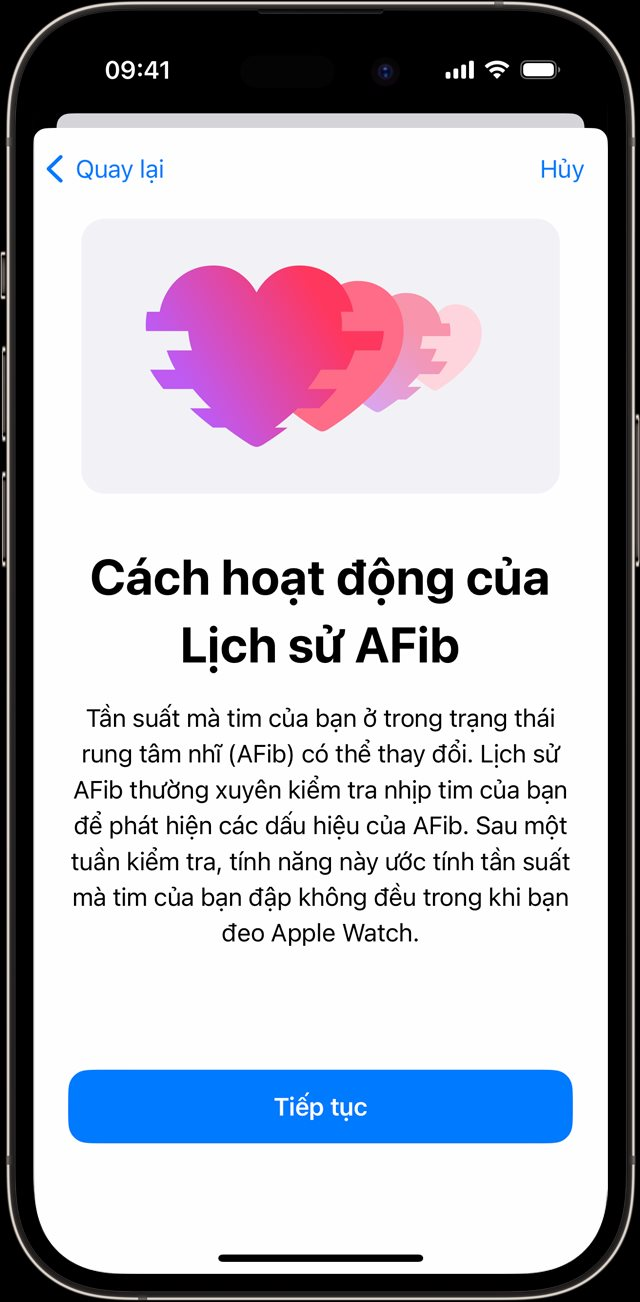 Một t&iacute;nh năng tr&ecirc;n Apple Watch đạt chứng nhận quan trọng của FDA Hoa Kỳ, k&iacute;ch hoạt ngay để theo d&otilde;i sức khoẻ tim mạch! - Ảnh 5.