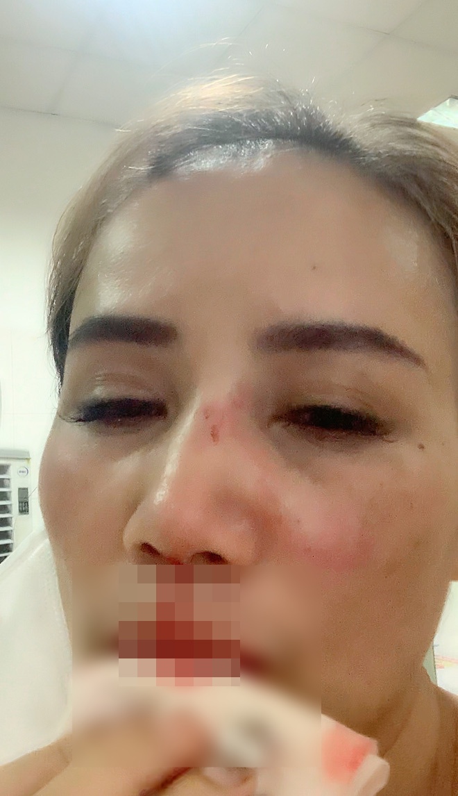 Nữ diễn viên bị chồng thứ 4 đánh thẳng vào mũi, dùng dao đe doạ gây chấn động Vbiz - Ảnh 3.