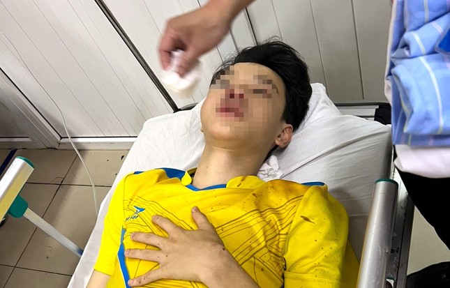 Trên đường đi thi lớp 10, nam sinh bị tai nạn phải bỏ thi - Ảnh 1.