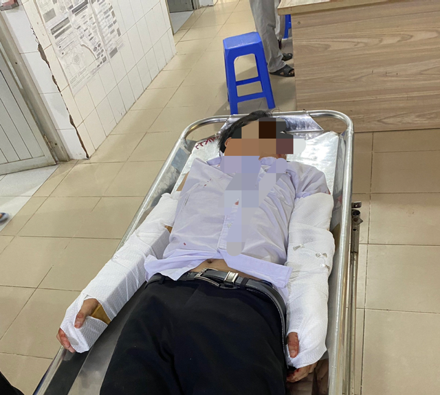 Nam sinh bị tai nạn khi đi thi tốt nghiệp có được đặc cách? - Ảnh 1.