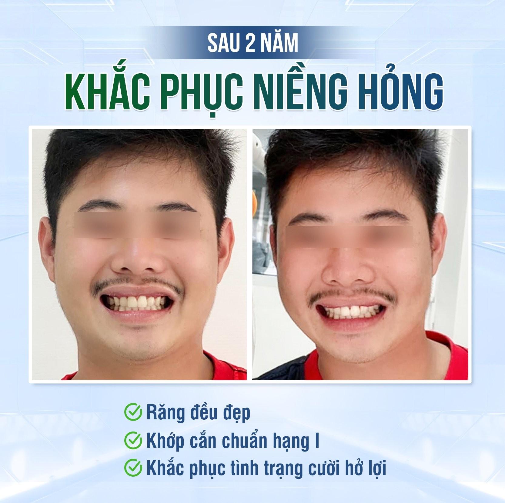 Bác sĩ Phạm Thị Bích Ngọc - Chuyên gia giải cứu niềng hỏng- Ảnh 5.