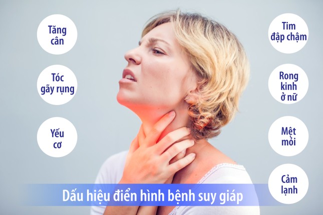 Có những biểu hiện này, hãy đến bệnh viện kiểm tra ngay tuyến giáp của bạn- Ảnh 1.