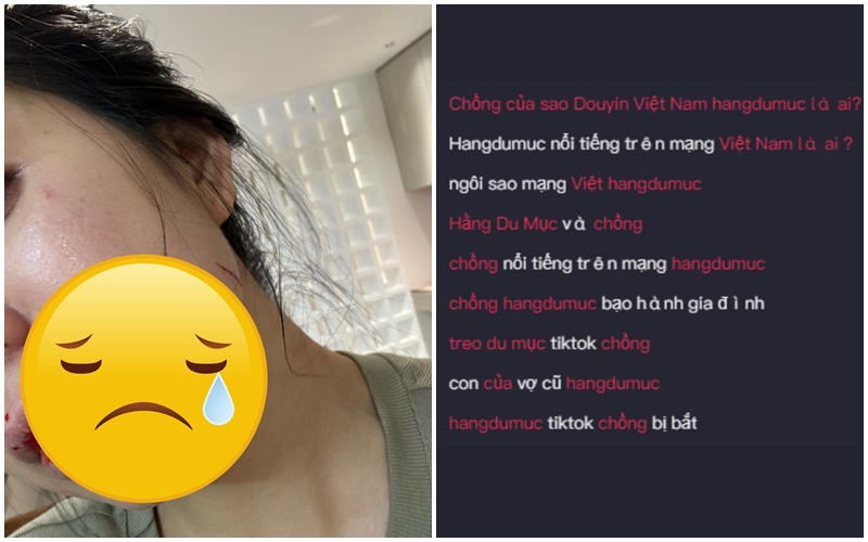 Vụ Hằng Du Mục bị chồng bạo hành lọt tìm kiếm phổ biến, netizen nước bạn nói gì?