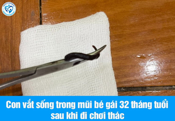 Thấy bé gái có biểu hiện lạ sau nửa tháng tắm thác nước, bố mẹ cho nhập viện thì phát hiện thứ đáng sợ trong mũi con- Ảnh 1.