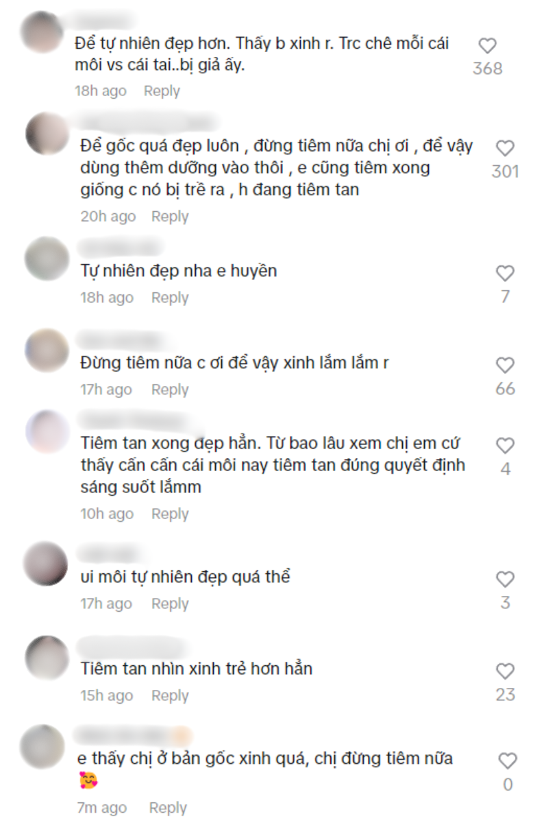 Một nàng WAG Việt từ bỏ môi mọng vì hệ quả tiêm filler, visual mới được netizen khen hết lời- Ảnh 4.