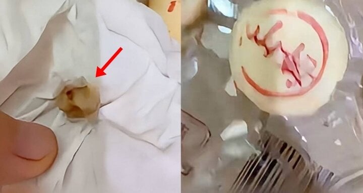 C&ocirc; g&aacute;i sốc nặng khi ph&aacute;t hiện răng người trong b&aacute;nh trung thu- Ảnh 1.