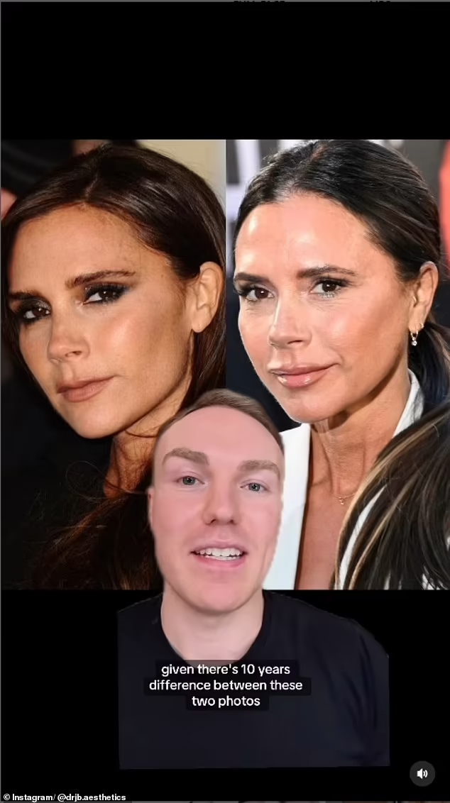 Thập kỷ không tuổi của Victoria Beckham bắt đầu từ khi quyết định làm 2 việc, được BS thẩm mỹ không ngớt lời khen ngợi- Ảnh 4.