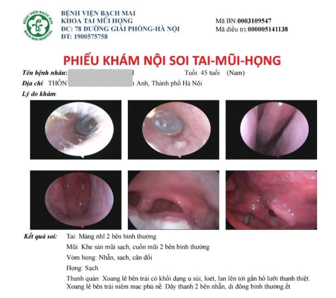 Ung thư 'gõ cửa' sau nhiều năm duy trì 2 thói xấu- Ảnh 1.