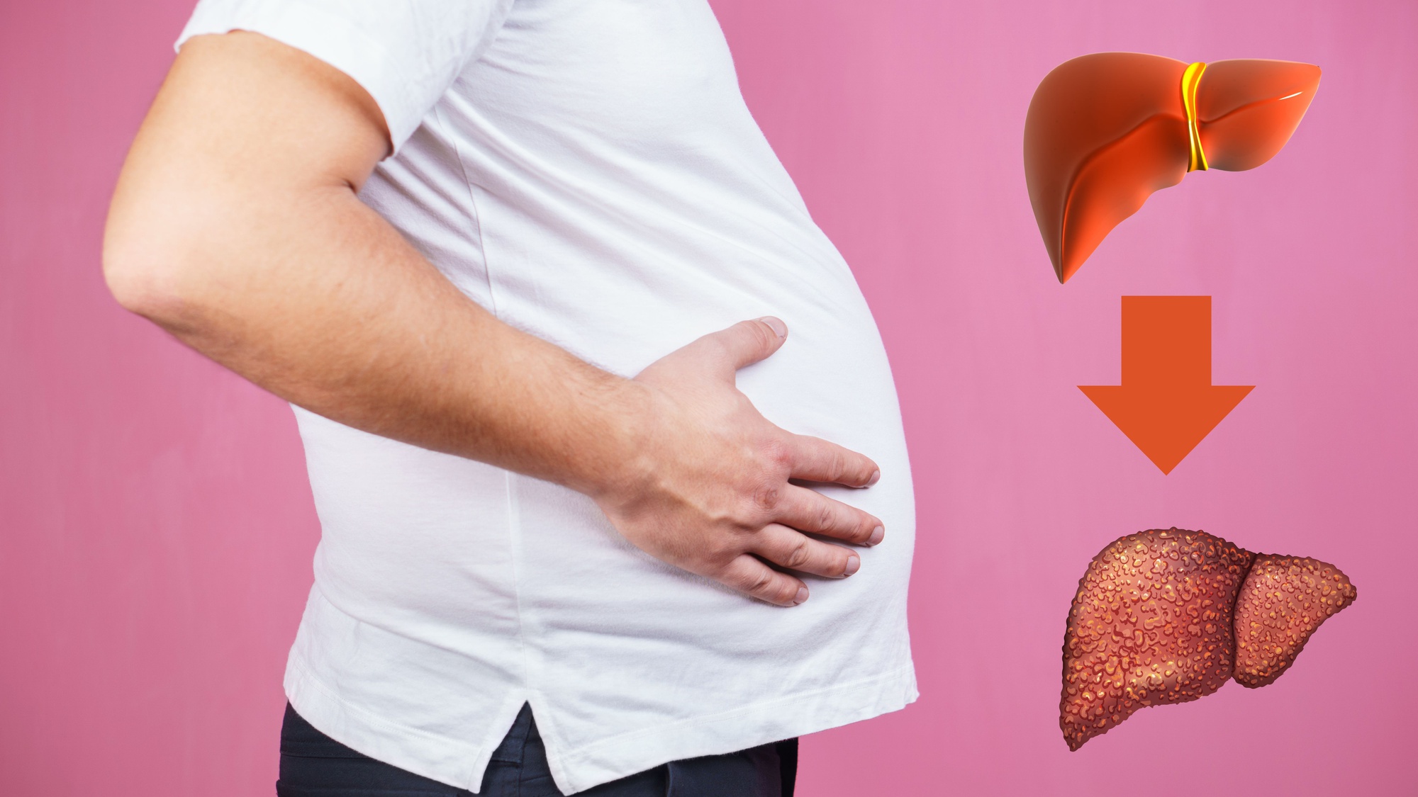 Đây là 6 triệu chứng sớm nhất của ung thư gan: Nhiều người không biết nên bỏ qua- Ảnh 4.