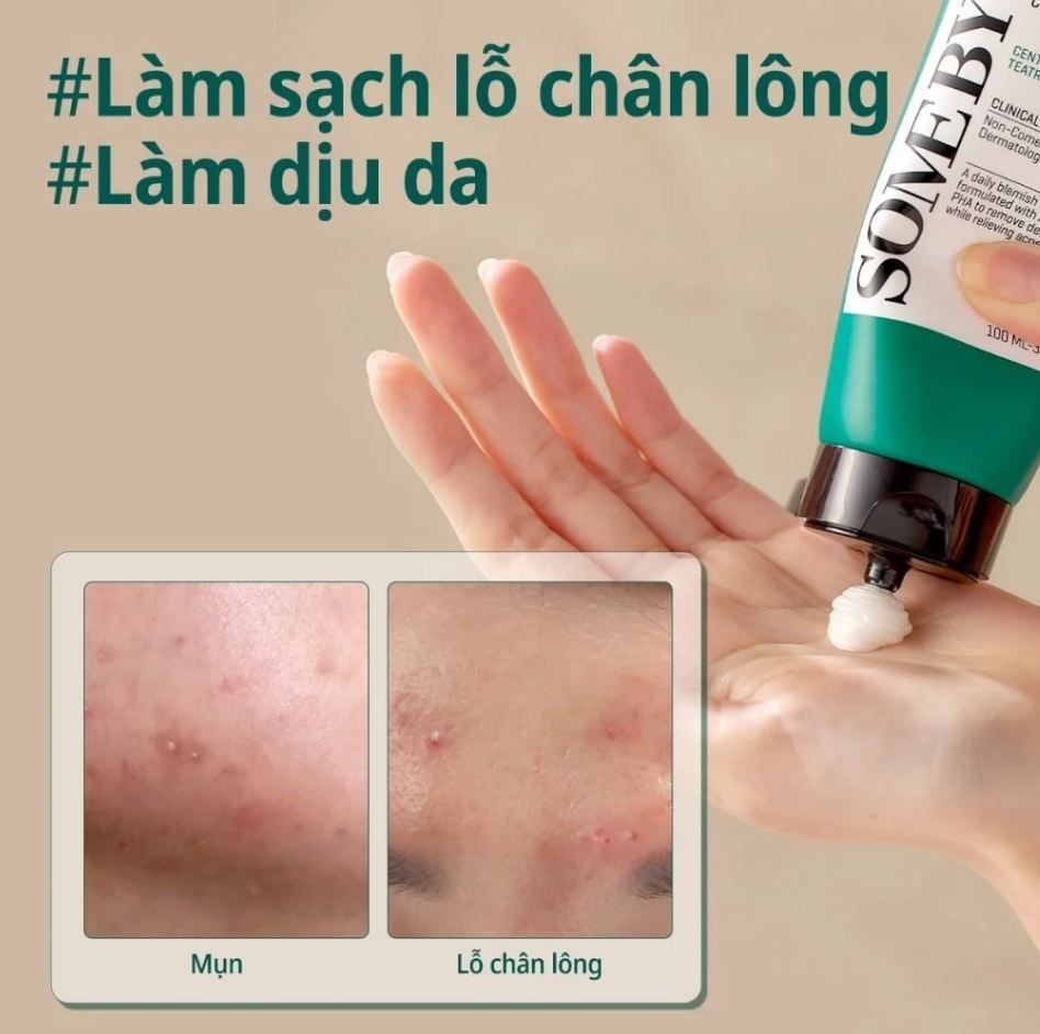 6 sữa rửa mặt được đánh giá cao vì khả năng làm sạch sâu mà không làm khô da- Ảnh 4.