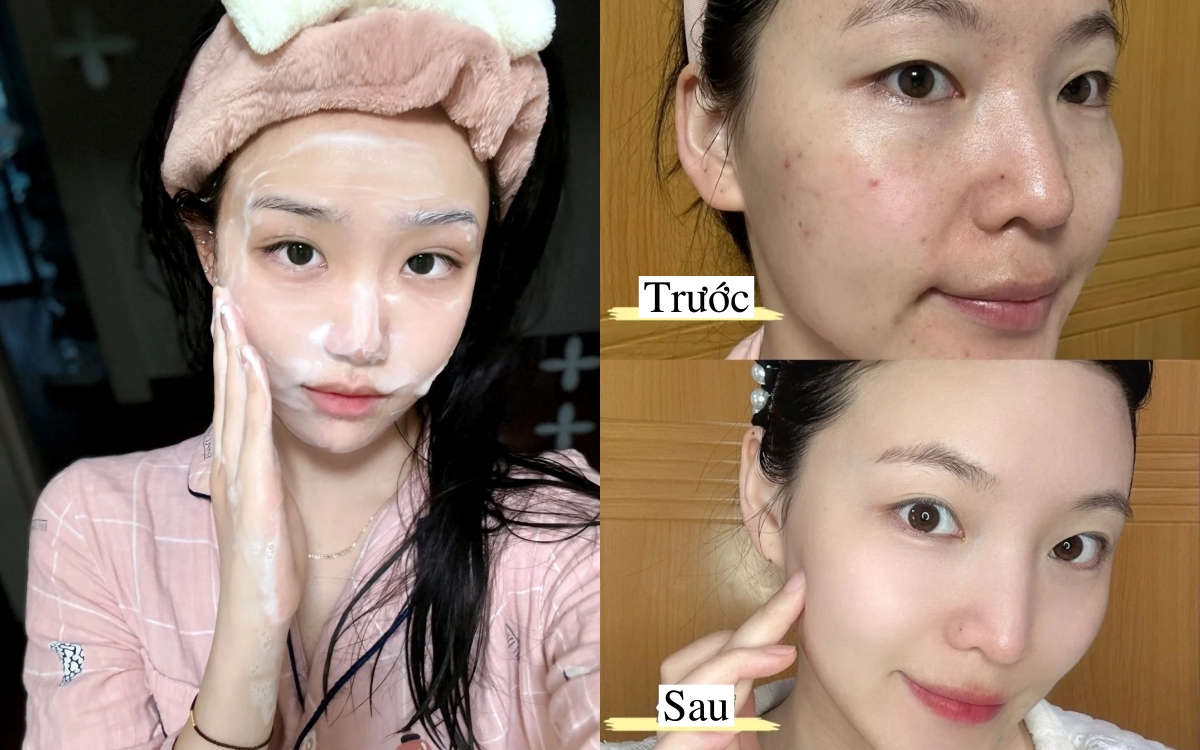 6 sữa rửa mặt được đánh giá cao vì khả năng làm sạch sâu mà không làm khô da- Ảnh 1.