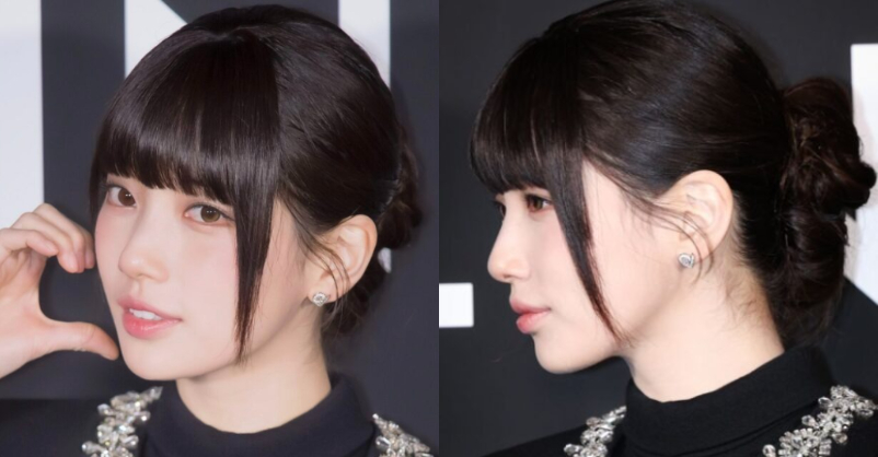 Hình ảnh gây sốc của Suzy trước khi phẫu thuật- Ảnh 4.