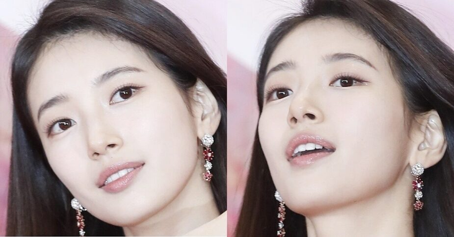 Hình ảnh gây sốc của Suzy trước khi phẫu thuật- Ảnh 5.