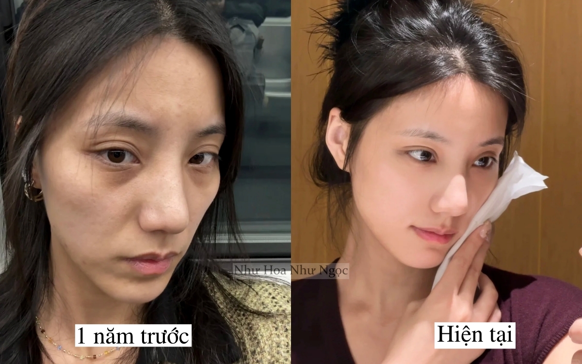 Tôi lấy lại làn da tuổi 20 nhờ 1 năm ngủ sớm, ăn lành và chăm da đúng cách- Ảnh 3.