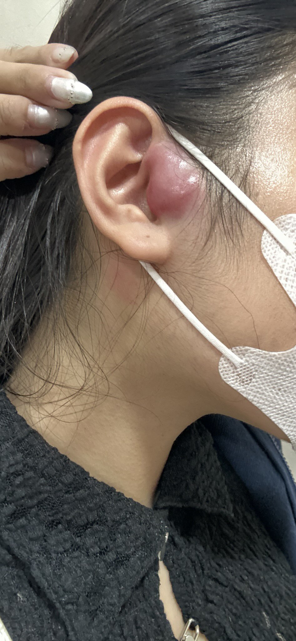 Cô gái TP.HCM 24 tuổi bị ung thư hạch giai đoạn 4: Bác sĩ nói lý do có thể đến từ... mọi thứ- Ảnh 3.