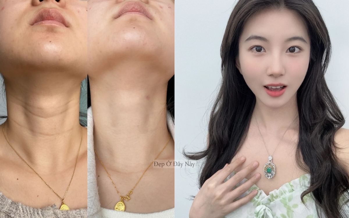 Phụ nữ Trung Quốc làm điều này 15 phút mỗi ngày để "là phẳng" nếp nhăn vùng cổ- Ảnh 1.