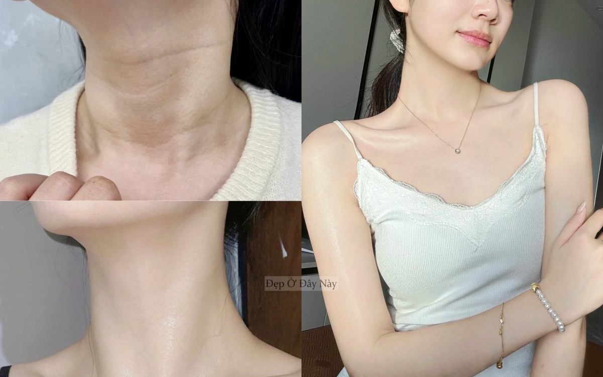 Phụ nữ Trung Quốc làm điều này 15 phút mỗi ngày để "là phẳng" nếp nhăn vùng cổ- Ảnh 2.