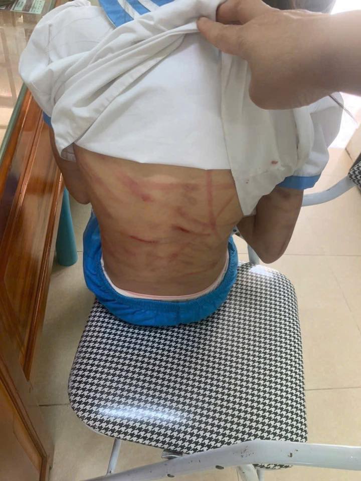 Xác minh thông tin bé gái nghi bị cha dượng bạo hành- Ảnh 1.
