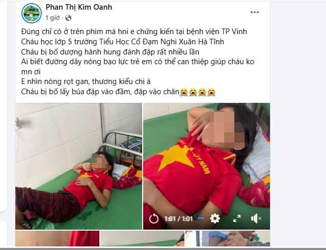 Xác minh thông tin bé gái nghi bị cha dượng bạo hành- Ảnh 4.