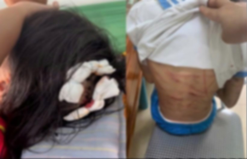 Bé gái lớp 5 nghi bị bố dượng bạo hành đã mở cửa sổ cầu cứu hàng xóm: Thêm loạt chi tiết gây phẫn nộ- Ảnh 1.