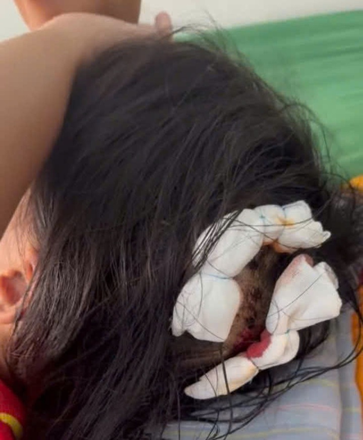Bắt giữ gã cha dượng bạo hành dã man bé gái lớp 5 ở Hà Tĩnh- Ảnh 2.