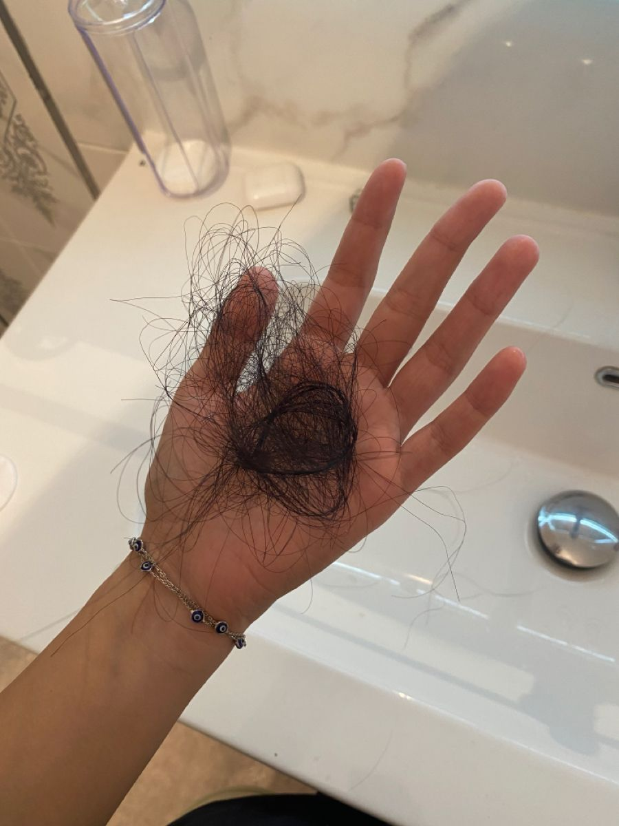 Tôi đã phục hồi mái tóc khô xơ gãy rụng của mình bằng cách dễ không tưởng, làm 1 lần đã có kết quả ngay- Ảnh 4.