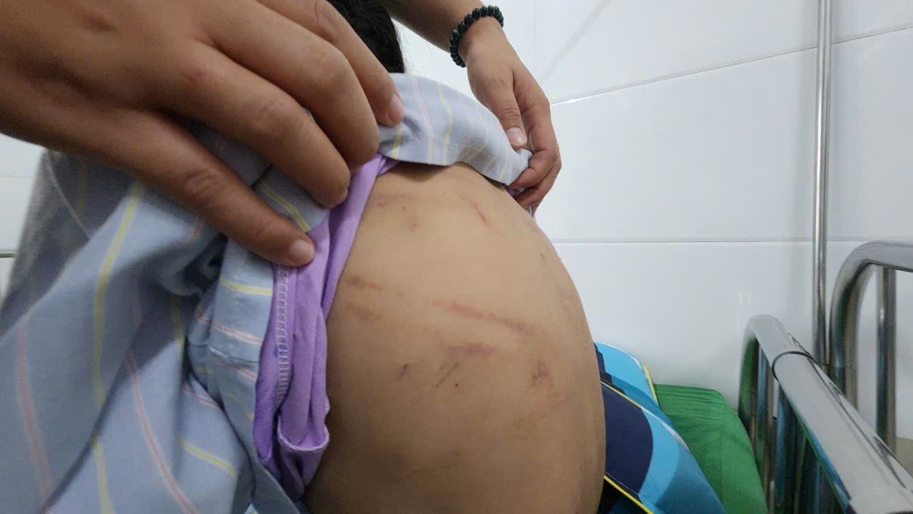 Bé gái bị cha dượng dùng búa bạo hành: Lời kể nghẹn ngào của nạn nhân- Ảnh 2.