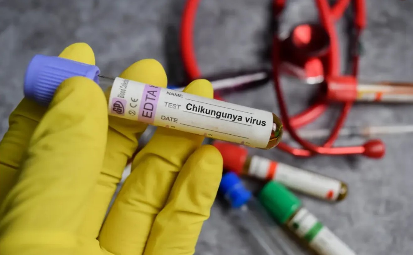 Loại virus khiến Trung Quốc phải kích hoạt kiểm soát dịch như thời Covid-19 đã xuất hiện ở quốc gia khác- Ảnh 2.