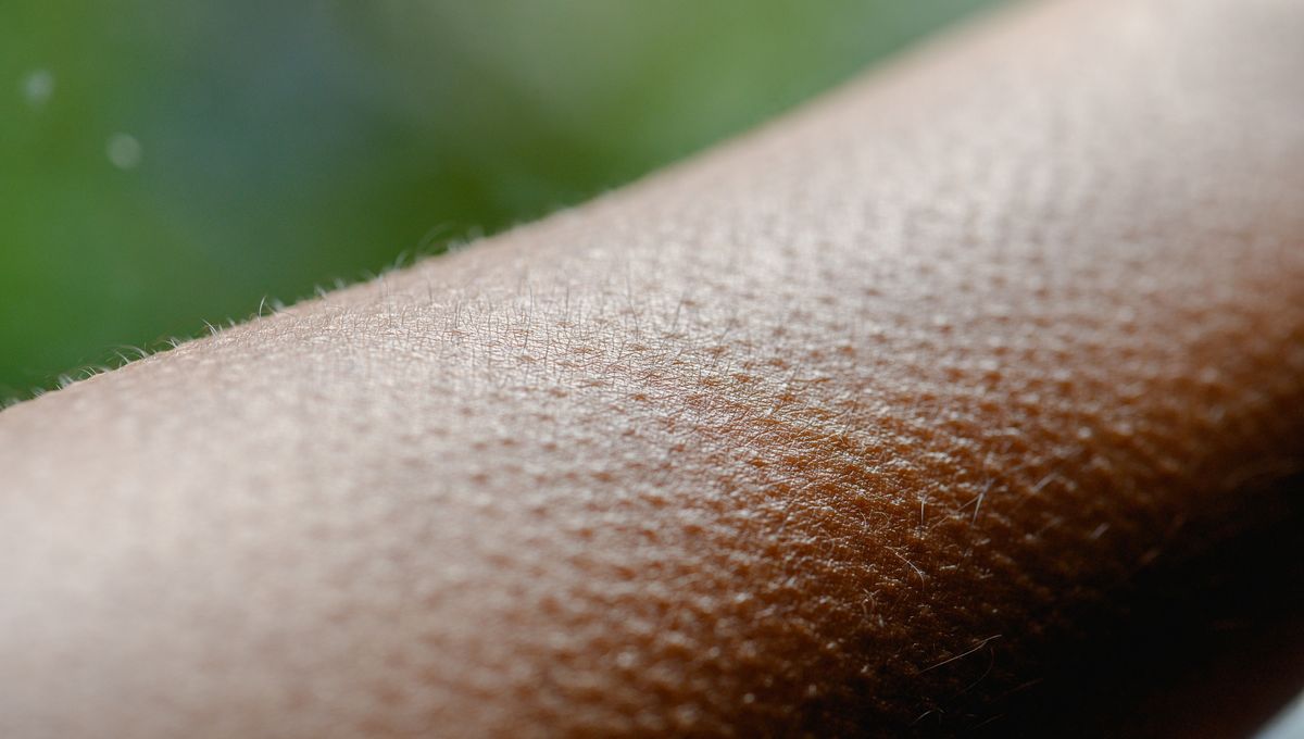 Tại sao chúng ta nổi da gà khi sợ hãi hoặc xúc động?- Ảnh 3.