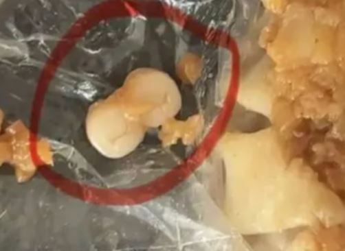 Hãi hùng: Phát hiện răng giả trong bánh, xúc xích, dimsum - Dư luận Trung Quốc dậy sóng- Ảnh 1.