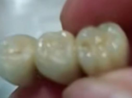 Hãi hùng: Phát hiện răng giả trong bánh, xúc xích, dimsum - Dư luận Trung Quốc dậy sóng- Ảnh 3.