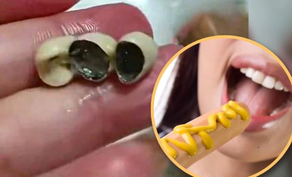 Hãi hùng: Phát hiện răng giả trong bánh, xúc xích, dimsum - Dư luận Trung Quốc dậy sóng- Ảnh 2.