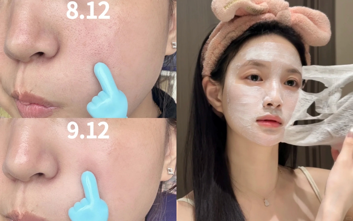 Lỗ chân lông từ to hóa nhỏ, mụn đầu đen đỡ 90% khi đắp loại mặt nạ này mỗi tuần- Ảnh 1.