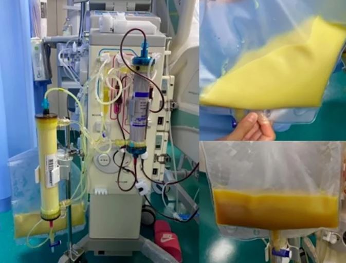 Người phụ nữ 27 tuổi "máu trắng đục" vì thường xuyên uống thứ nước vạn người mê- Ảnh 1.