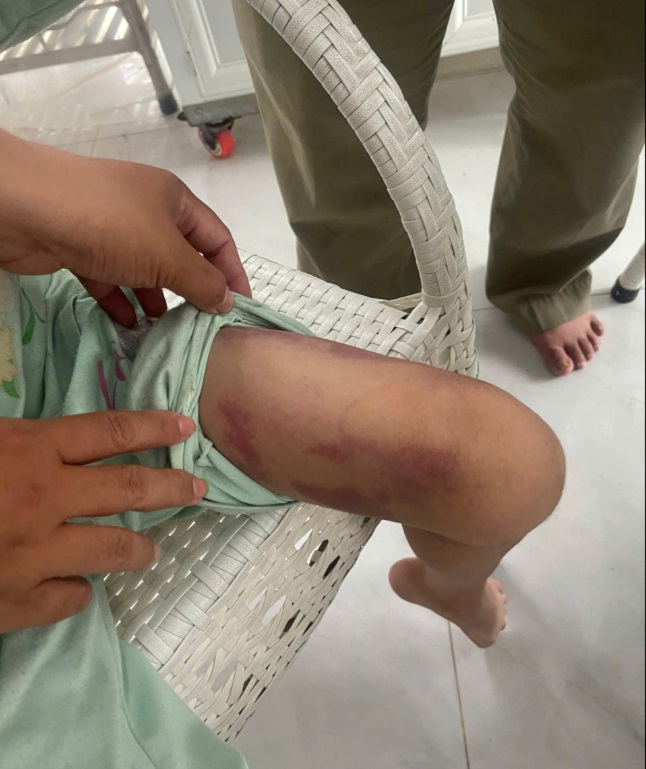 Mẹ ruột và người tình 19 tuổi thay nhau bạo hành dã man con gái 9 tuổi- Ảnh 1.