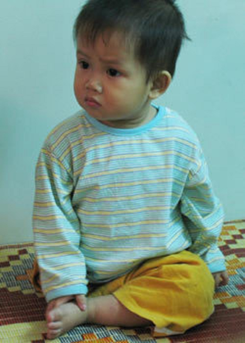 "Chú lính chì" Thiện Nhân: Từ nỗi đau thể xác của cậu bé 1 tuần tuổi bị bỏ rơi, đến chàng sinh viên 19 tuổi với suất học bổng 85%- Ảnh 3.