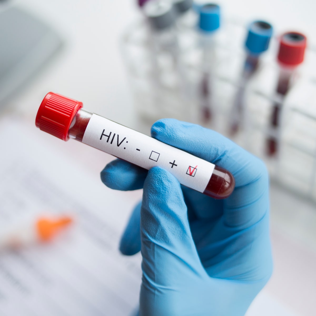 Sát ngày cưới, chú rể 27 tuổi phát hiện nhiễm HIV: Bác sĩ cảnh báo những nguồn lây nhiều người chủ quan- Ảnh 2. Sát ngày cưới, chú rể 27 tuổi phát hiện nhiễm HIV: Bác sĩ cảnh báo những nguồn lây nhiều người chủ quan- Ảnh 2.