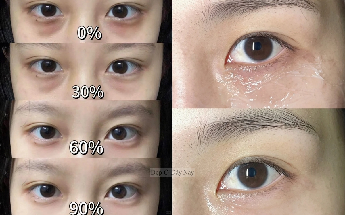 Cách đắp kem mắt giống Phạm Băng Băng khiến quầng thâm và nếp nhăn tự động "tiêu biến"- Ảnh 4. Cách đắp kem mắt giống Phạm Băng Băng khiến quầng thâm và nếp nhăn tự động "tiêu biến"- Ảnh 4.