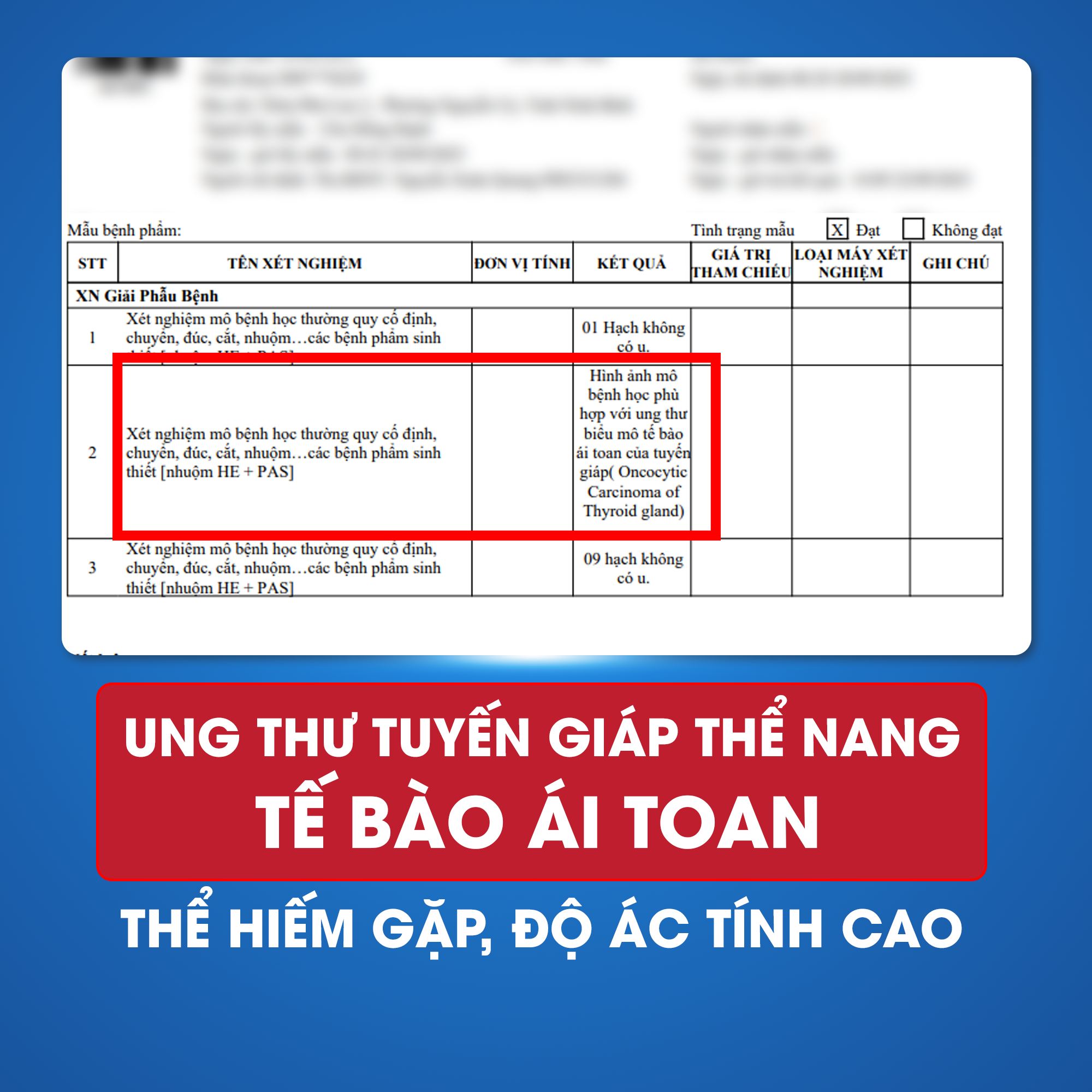 Bé trai 13 tuổi mắc ung thư tuyến giáp, phát triển nhanh chỉ trong vài tuần- Ảnh 2.
