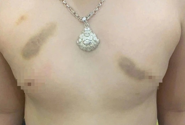 Phụ huynh tố gi&aacute;o vi&ecirc;n mầm non bạo h&agrave;nh trẻ, y&ecirc;u cầu bồi thường 1 năm học ph&iacute;?- Ảnh 1.