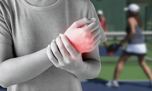 Bác sĩ ở Hà Nội chỉ ra những chấn thương phổ biến nhất khi chơi pickleball- Ảnh 2. Bác sĩ ở Hà Nội chỉ ra những chấn thương phổ biến nhất khi chơi pickleball- Ảnh 2.