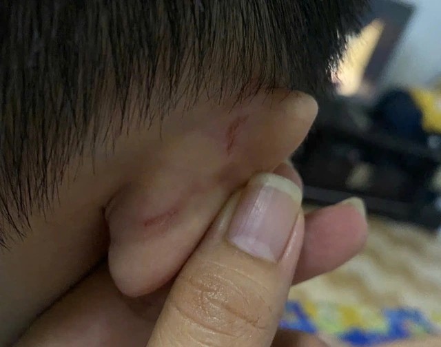 Phụ huynh tố giáo viên mầm non bạo hành trẻ, yêu cầu bồi thường 1 năm học phí?- Ảnh 2.