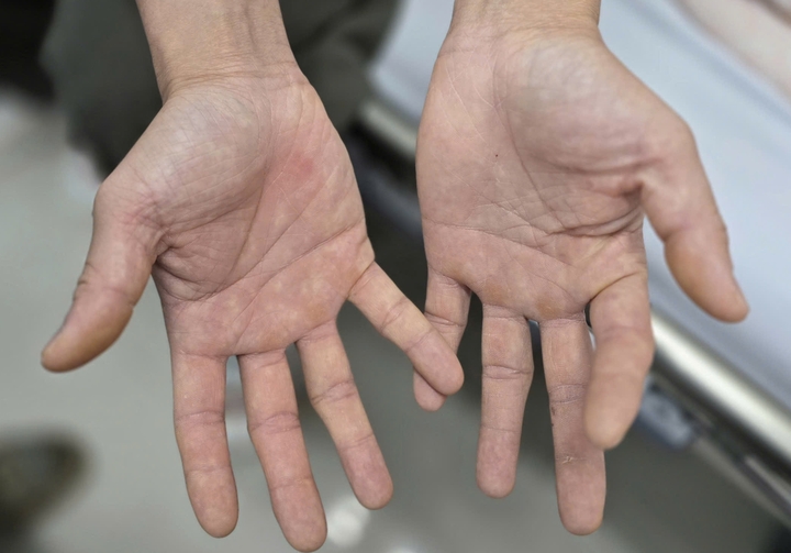 Liệt tứ chi vì 'thú vui' bóng cười- Ảnh 1. Liệt tứ chi vì 'thú vui' bóng cười- Ảnh 1.