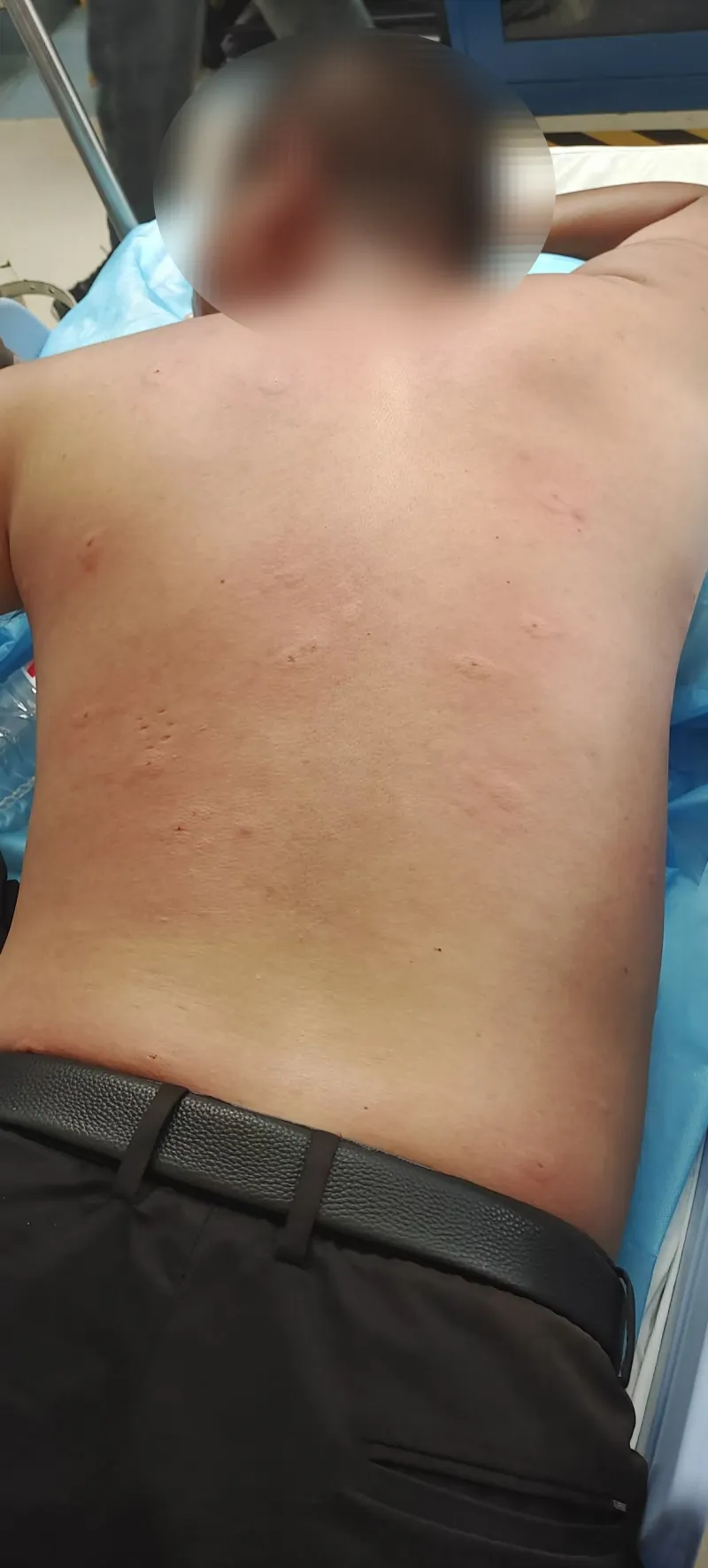 Mở cửa phòng, người đàn ông bị "hàng trăm mũi kim cắm khắp người"- Ảnh 2. Mở cửa phòng, người đàn ông bị "hàng trăm mũi kim cắm khắp người"- Ảnh 2.