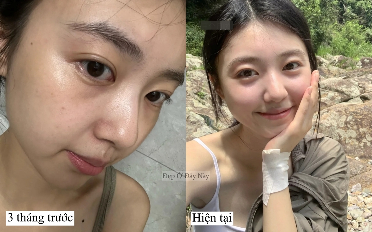 Cô gái bỏ trà sữa 3 tháng, da căng sáng như vừa đi spa dưỡng chuyên sâu- Ảnh 2. Cô gái bỏ trà sữa 3 tháng, da căng sáng như vừa đi spa dưỡng chuyên sâu- Ảnh 2.