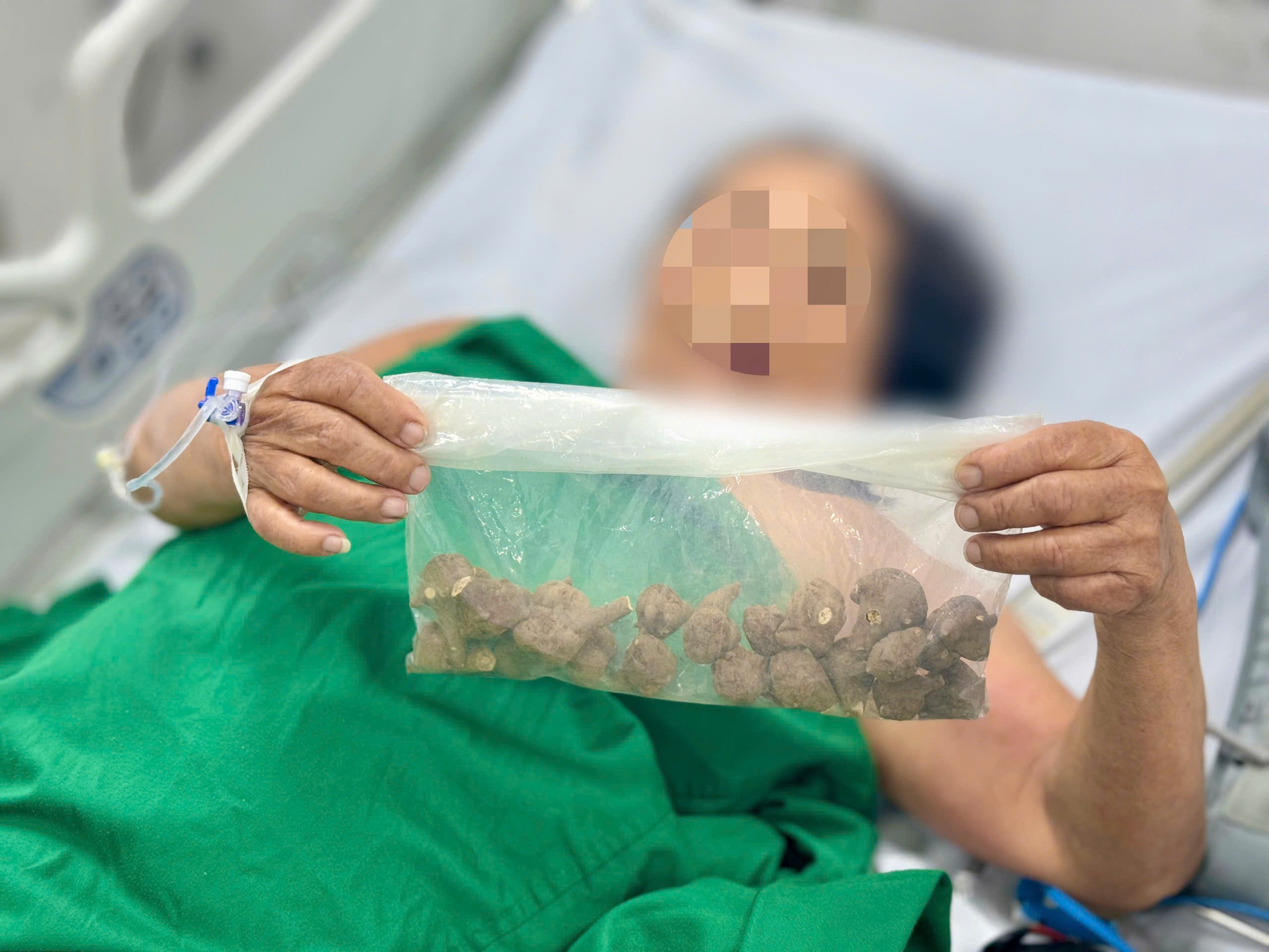 Cụ bà 78 tuổi ở Hà Nội bị sốc tim sau khi sử dụng 1 loại củ mua trên mạng- Ảnh 1.