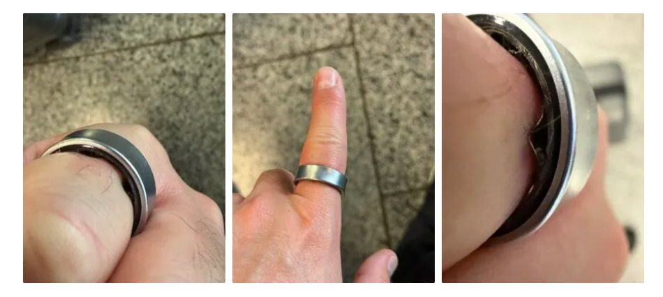Người dùng hốt hoảng khi một sản phẩm của Samsung phồng pin, kẹt luôn trên ngón tay: "Vừa đau vừa sợ nổ"- Ảnh 1.