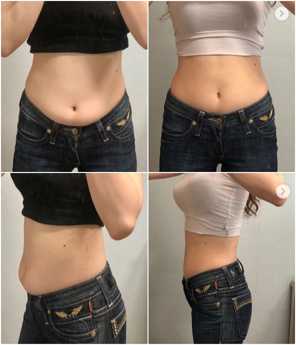 Tư thế Yoga khiến chân 