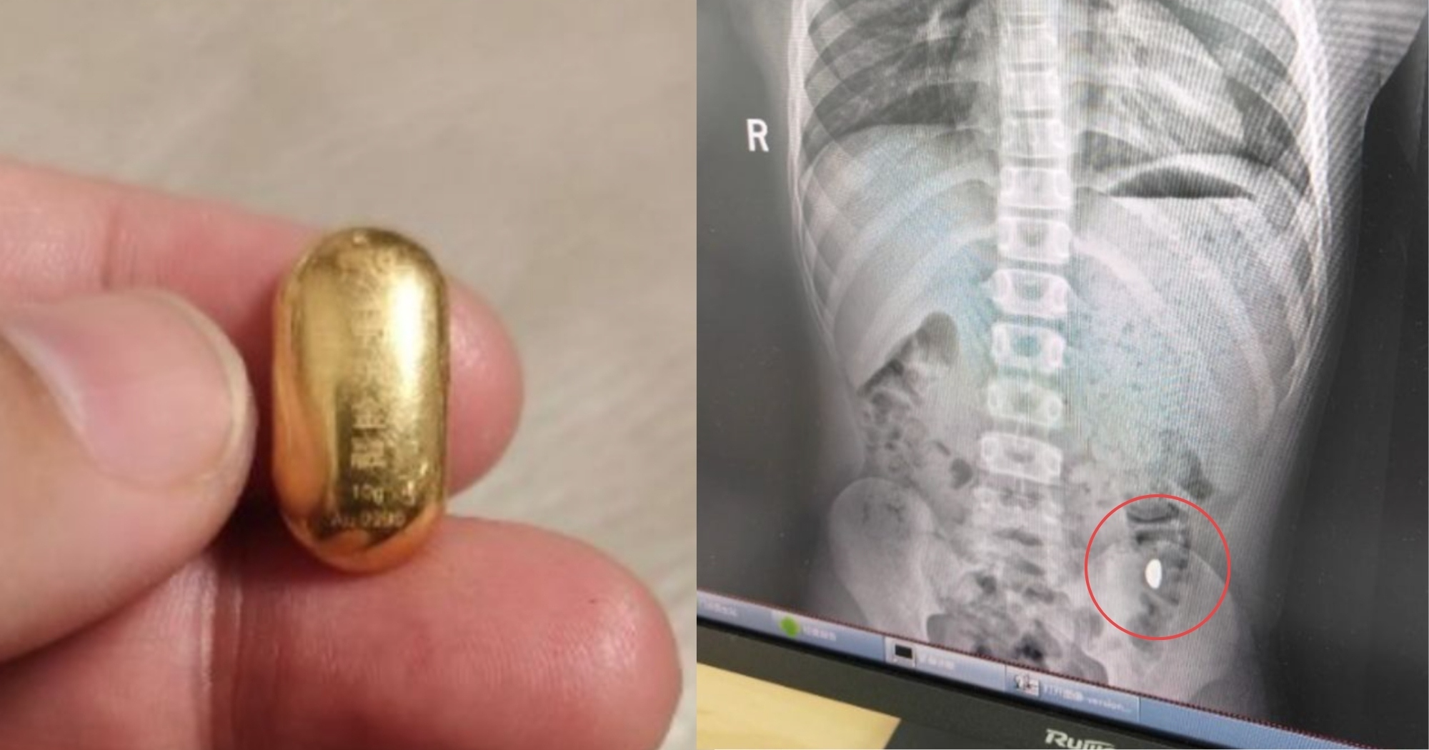 Con trai nuốt miếng vàng của mẹ vào bụng và cái kết- Ảnh 1. img