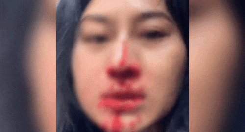 Diễn viên Phi Ngọc Ánh hoảng loạn cầu cứu- Ảnh 1. Diễn viên Phi Ngọc Ánh hoảng loạn cầu cứu- Ảnh 1.